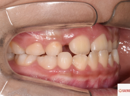 d1d86fa678bc9afe4b079fc3bd0a6047_1743648007_4704.png d1d86fa678bc9afe4b079fc3bd0a6047_1743648007_4704.png